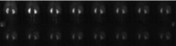 Nuclear medicine images from a normal functional kidney.