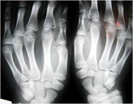 X-ray of the hands.